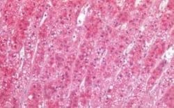 TIAM1 Antibody, Novus Biologicals 50 &mu;g; Unconjugated:Antibodies, Polyclonal